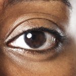 Opération des yeux au laser : quelles solutions pour corriger la myopie ?